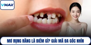 mơ rụng răng